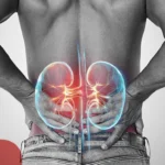 Early Signs of Kidney Disease You Shouldn’t Ignore