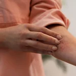 Your Essential Guide to Living With Adhesive Allergy