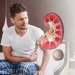 What Can Mimic Kidney Stone Pain? Common Conditions Explained