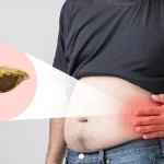 What To Know About Life Expectancy With Fatty Liver Disease?