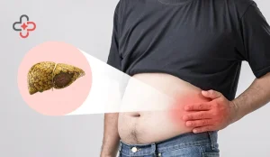 What To Know About Life Expectancy With Fatty Liver Disease?