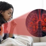 Multifocal Pneumonia: Causes, Symptoms & Treatment Options