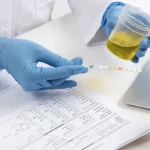 Leukocytes in Urine Explained Causes, Diagnosis and Treatment