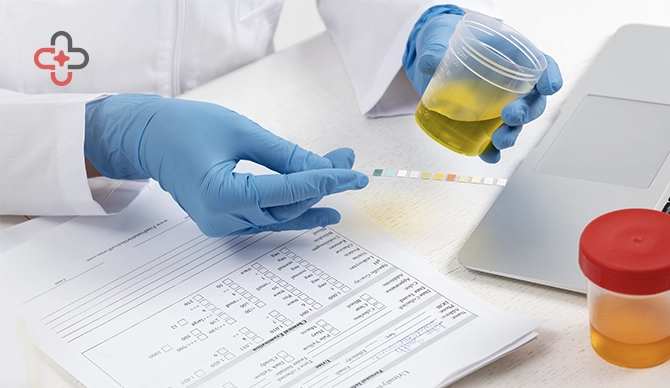 Leukocytes in Urine Explained Causes, Diagnosis and Treatment