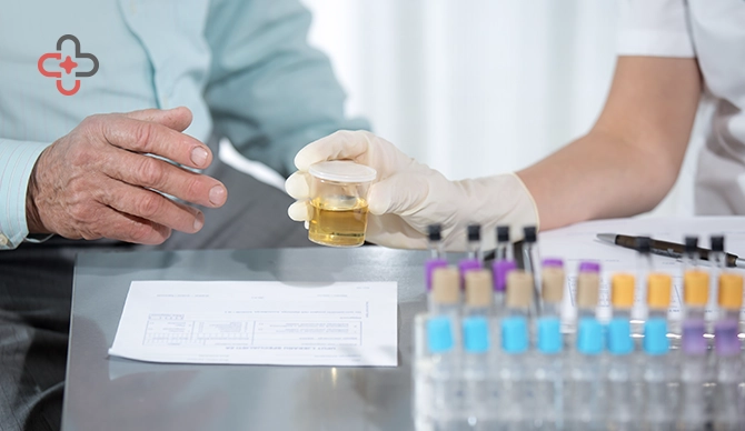 Mucus in Urine: Causes, Symptoms and What It Means