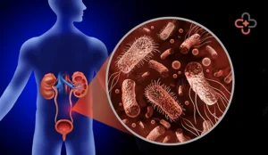 Urinary Tract Infection Causes, Symptoms And Treatment Options