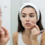 Blood Filled Pimple: What It Is & How To Treat It Safely