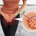 What Size Of Ovarian Cyst Is Dangerous? Types Of Cysts & Their Risks
