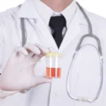 occult blood in urine