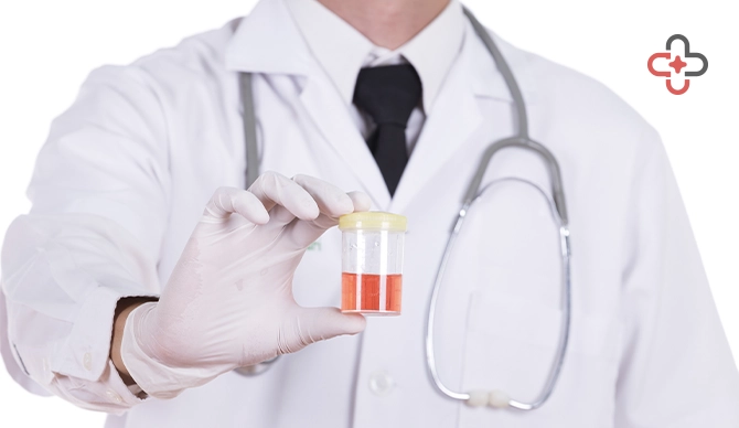 occult blood in urine